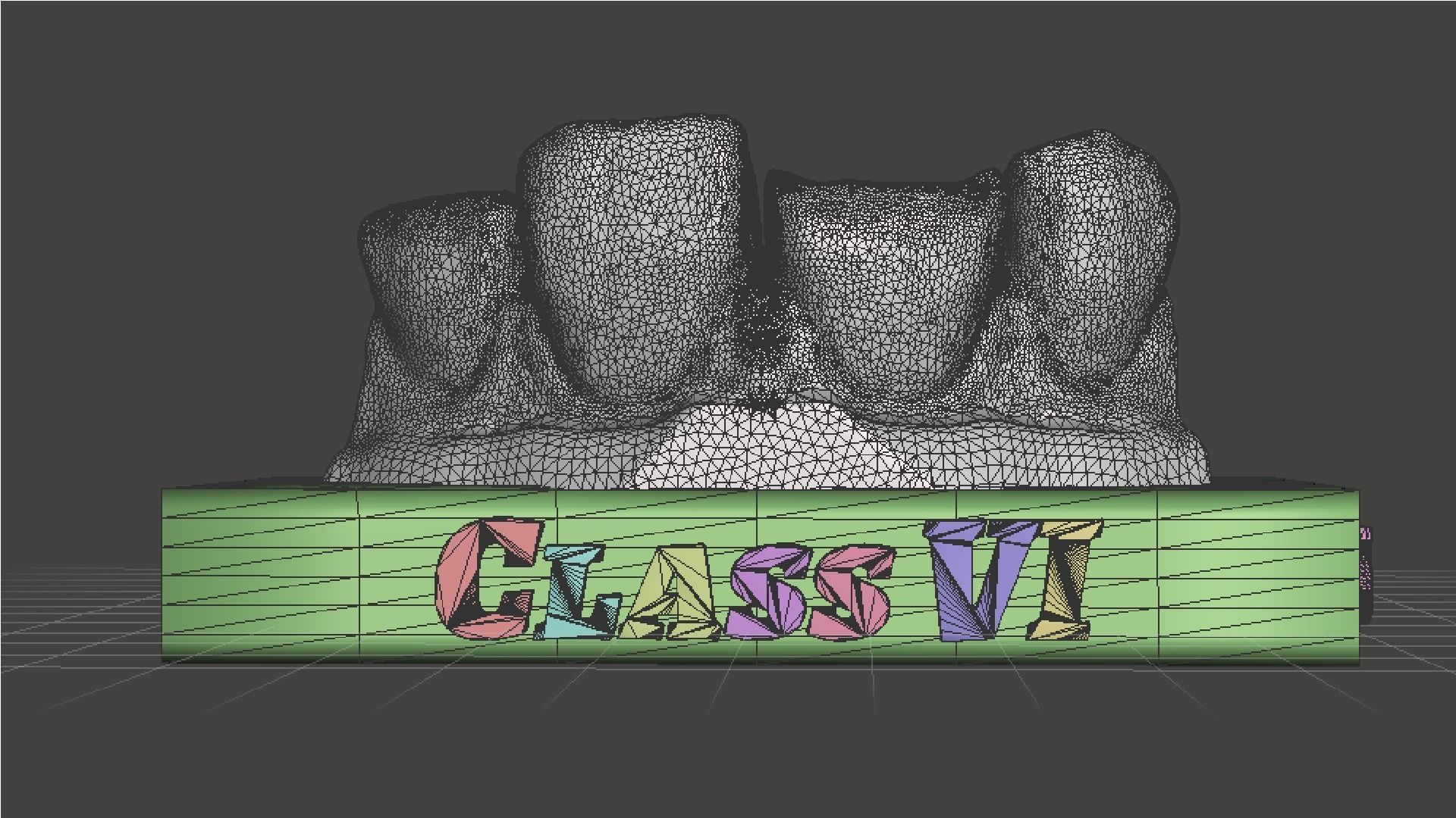 EDM Dental Practice Standard Upper Model Class 6 3D print model_7