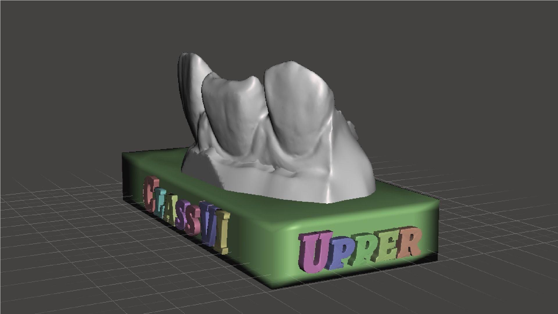 EDM Dental Practice Standard Upper Model Class 6 3D print model_5