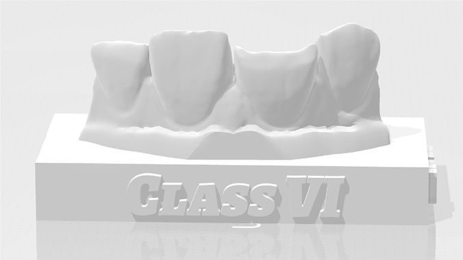 EDM Dental Practice Standard Upper Model Class 6 3D print model