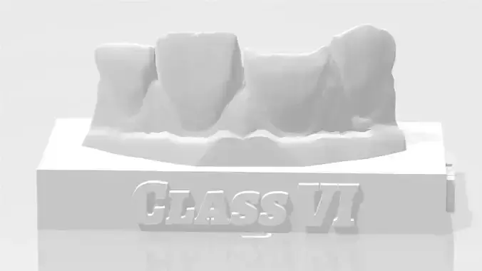 EDM Dental Practice Standard Upper Model Class 6 3D print model