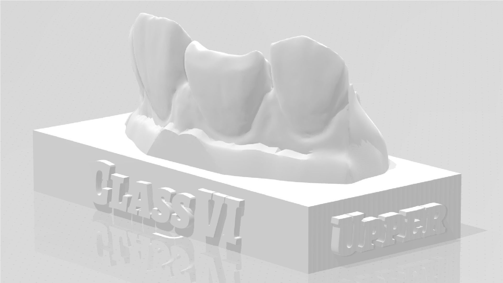 EDM Dental Practice Standard Upper Model Class 6 3D print model_2