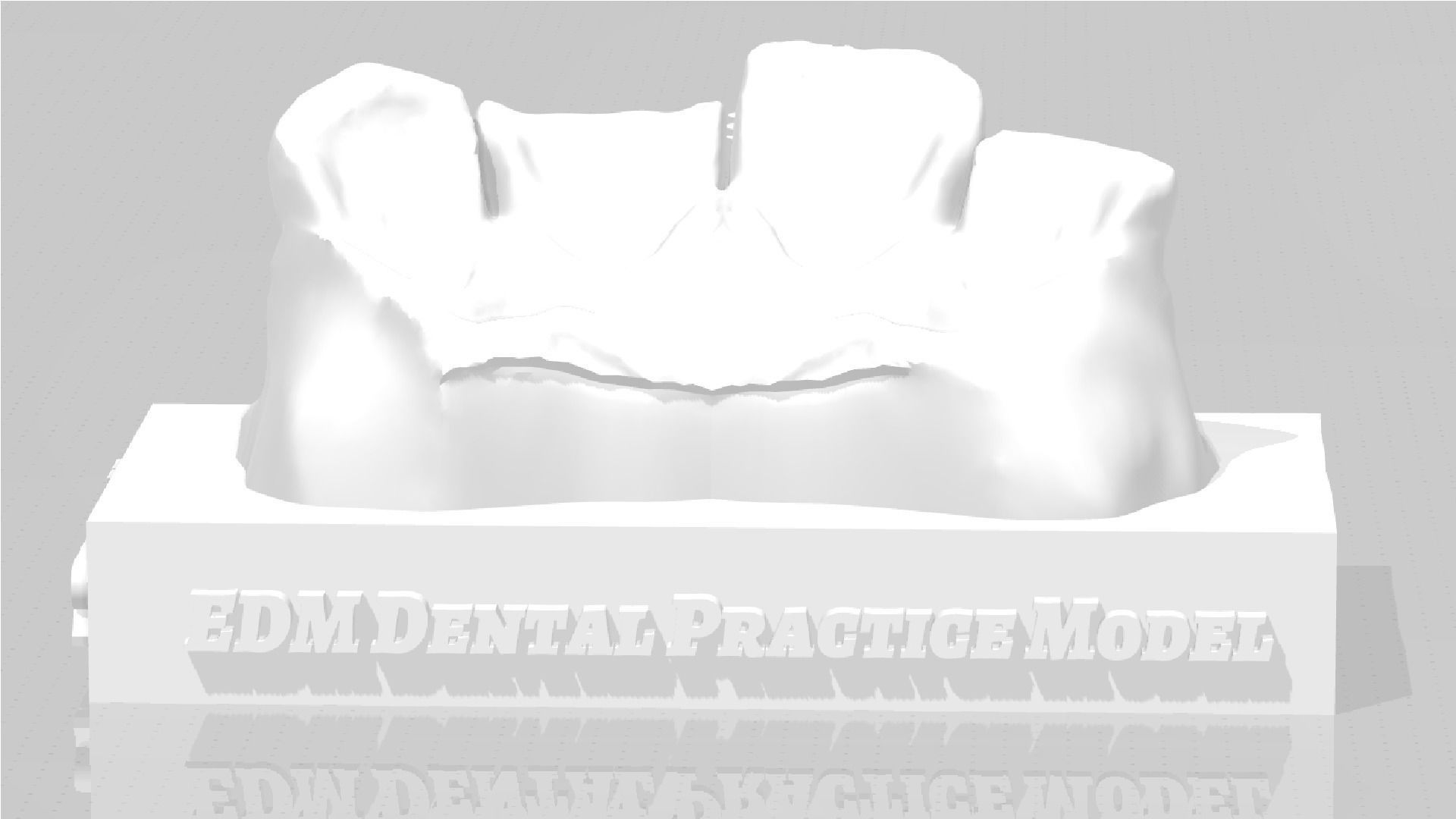 EDM Dental Practice Standard Upper Model Class 6 3D print model_3