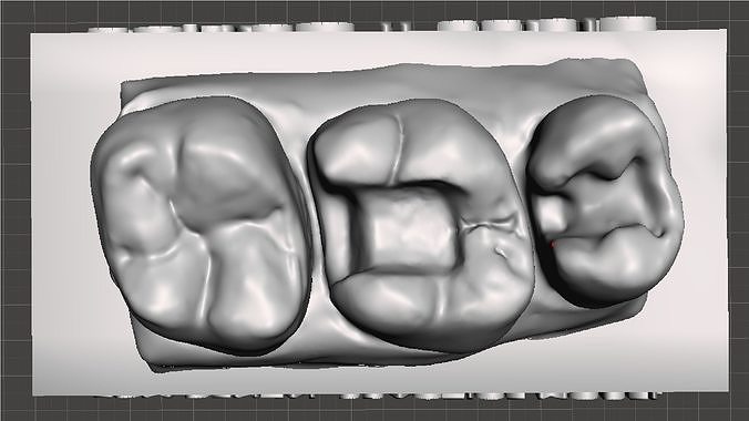 EDM Dental Practice Standard Upper Model Class 2 for M1 and P2 3D print model