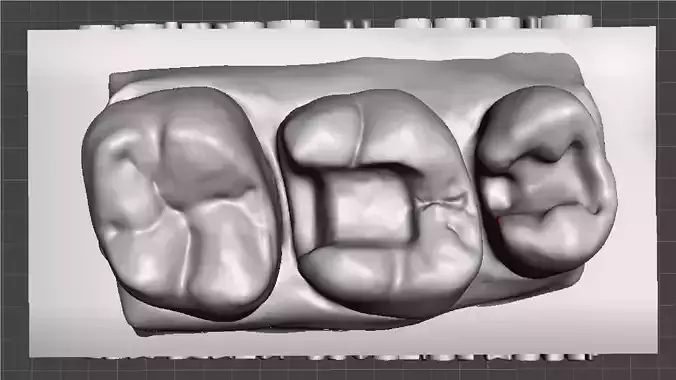 EDM Dental Practice Standard Upper Model Class 2 for M1 and P2 3D print model