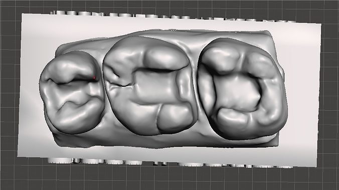 EDM Dental Practice Standard Upper Model Class 2  for M1 M2 P2 3D print model