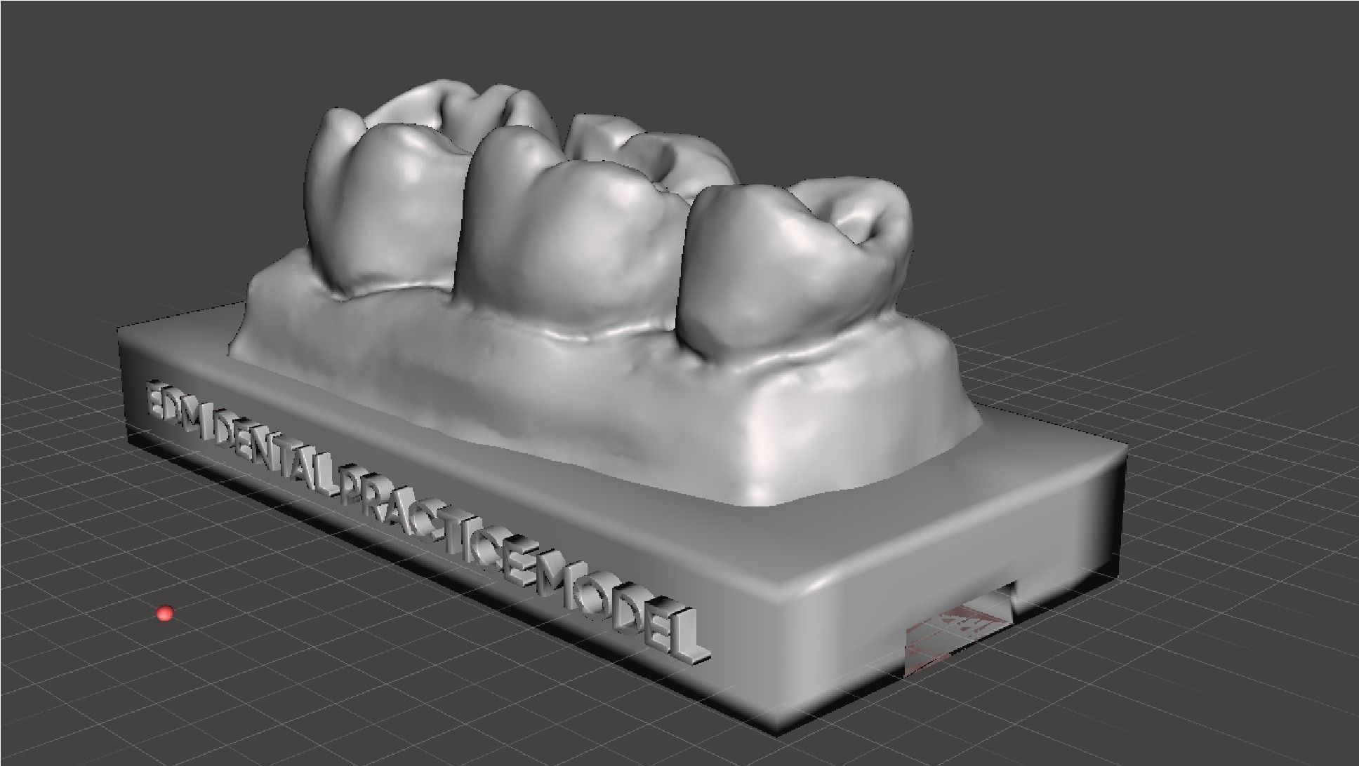 EDM Dental Practice Standard Upper Model Class 1 and 2 3D print model_1