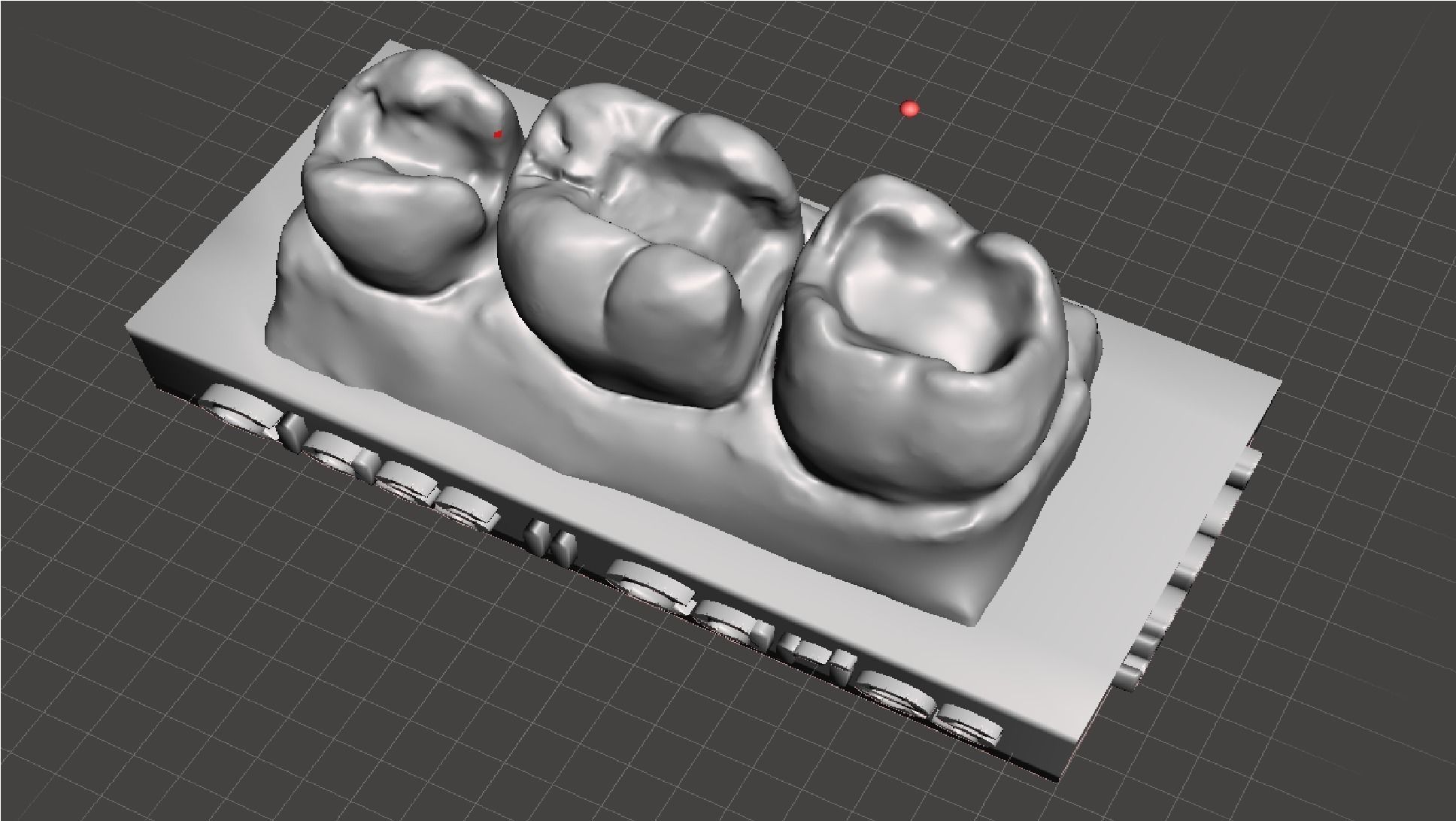 EDM Dental Practice Standard Upper Model Class 1 and 2 3D print model_2
