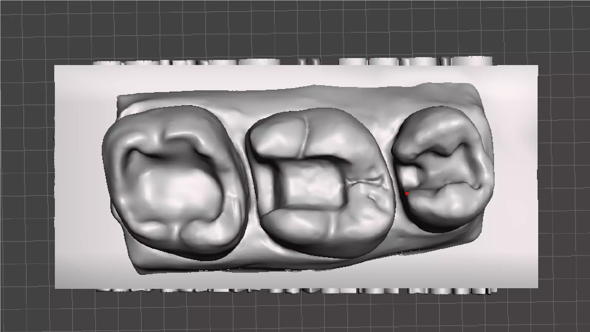 EDM Dental Practice Standard Upper Model Class 1 and 2 3D print model_0