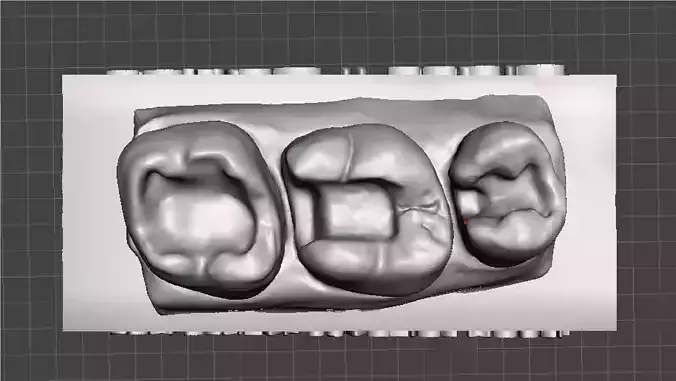EDM Dental Practice Standard Upper Model Class 1 and 2 3D print model