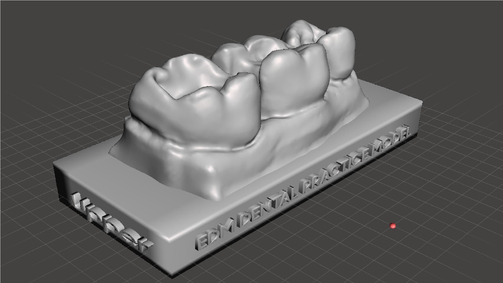 EDM Dental Practice Standard Upper Model Class 1 and 2 3D print model_3