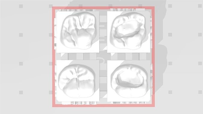 EDM Dental Practice High Detail Anatomy Focus 1st Molar  3D print model