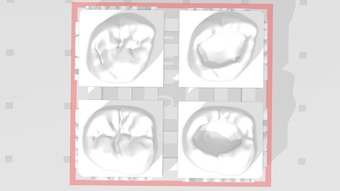 EDM Dental Practice High Detail Anatomy Focus 2nd Molar  3D print model