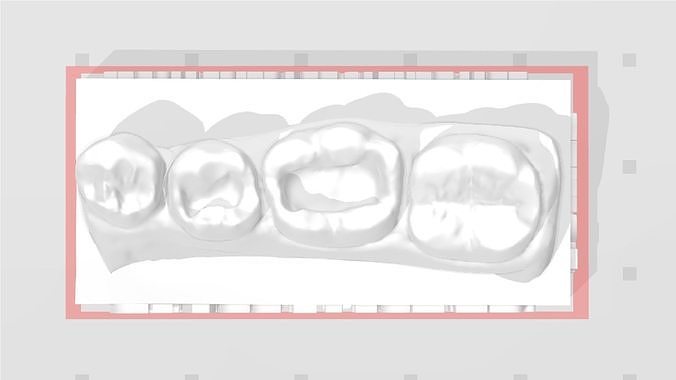 EDM Dental Practice Model Standard Lower Class 1  3D print model