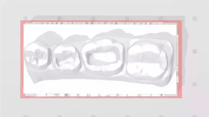EDM Dental Practice Model Standard Lower Class 1  3D print model
