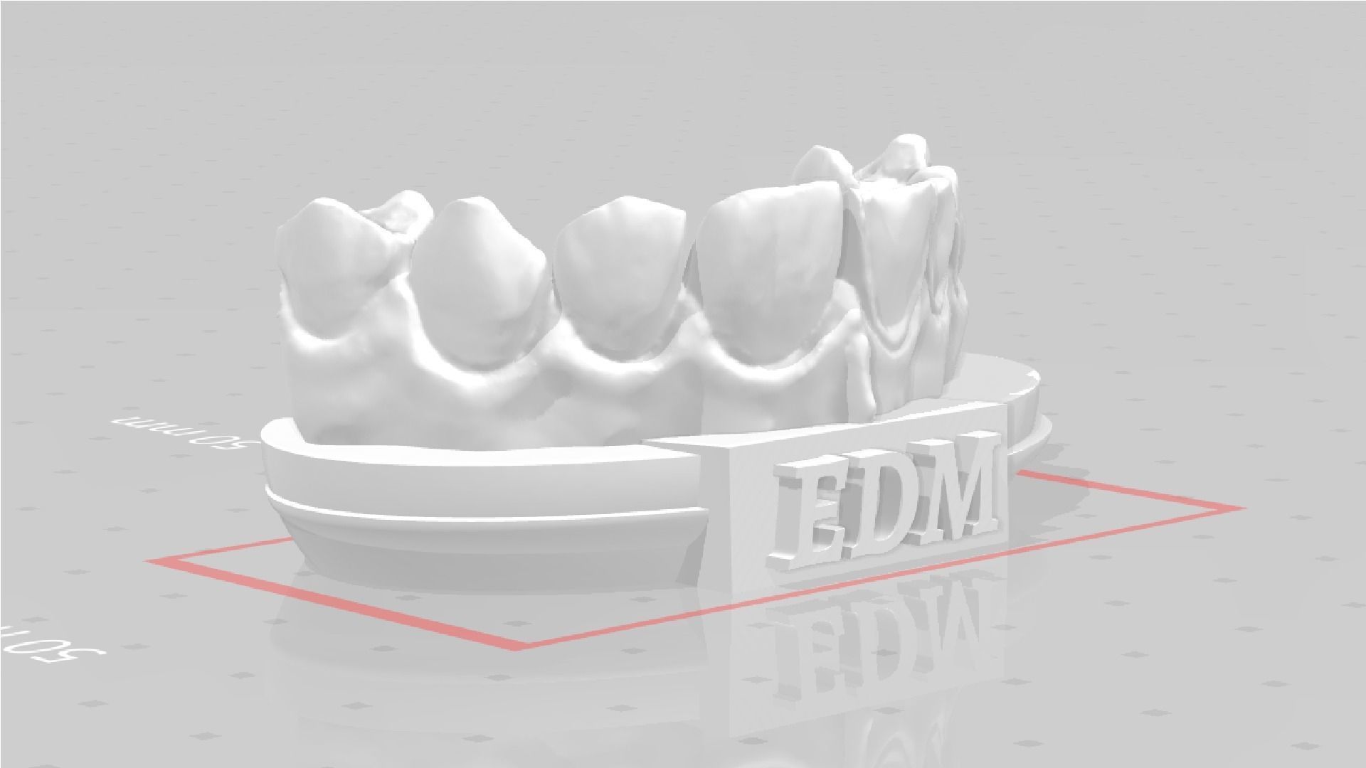 EDM Dental Practice Higher Quality Model Direct Veneer 3D print model_6