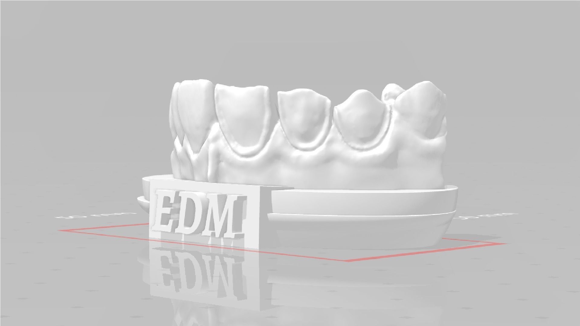 EDM Dental Practice Higher Quality Model Direct Veneer 3D print model_5