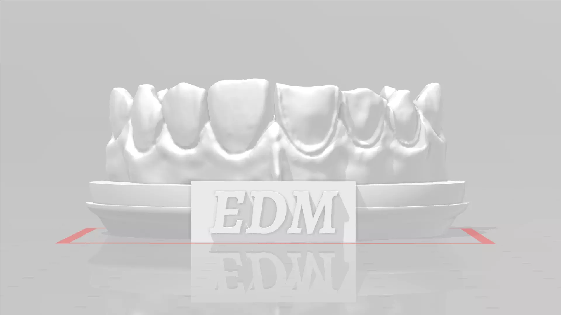 EDM Dental Practice Higher Quality Model Direct Veneer 3D print model_0