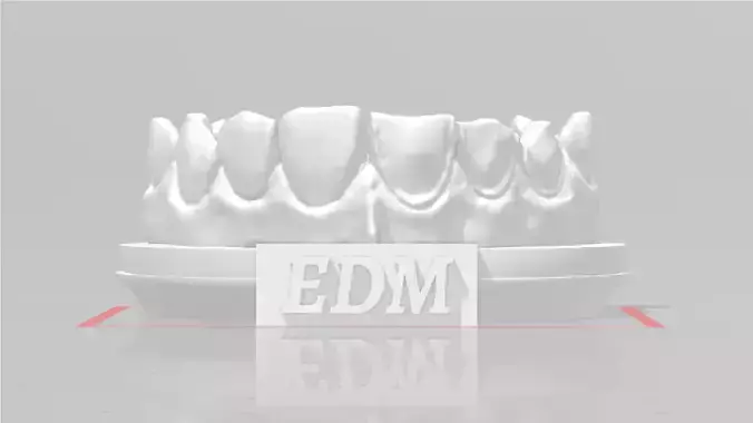 EDM Dental Practice Higher Quality Model Direct Veneer 3D print model