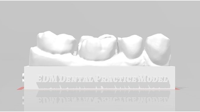 EDM Dental Practice Standard Lower Model Class 2 3D print model