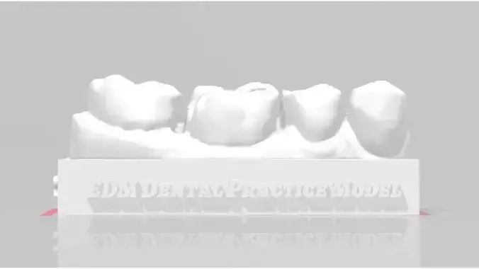 EDM Dental Practice Standard Lower Model Class 2 3D print model