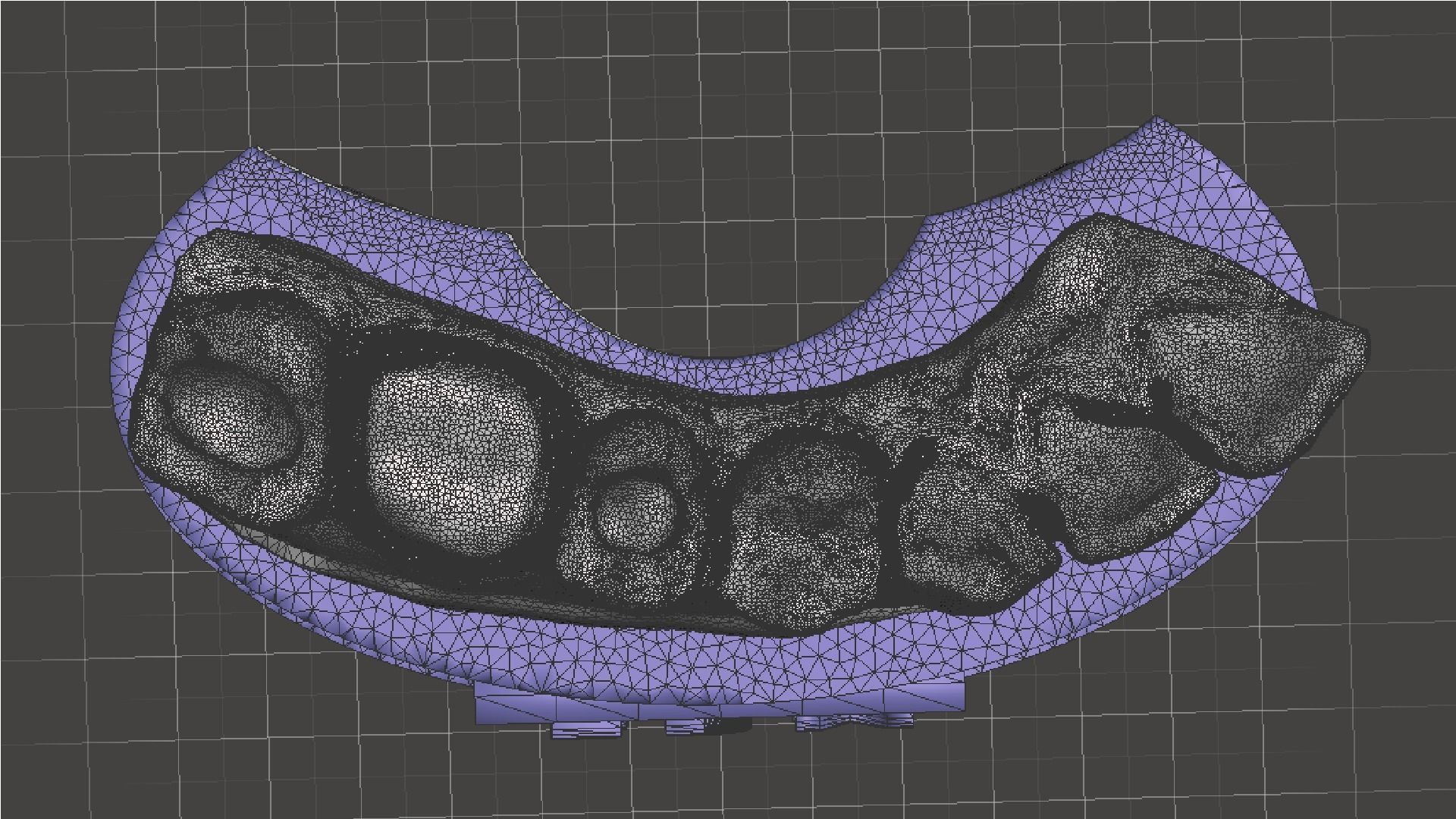 EDM Dental Practice Model Crown and Class 1 3D print model_6