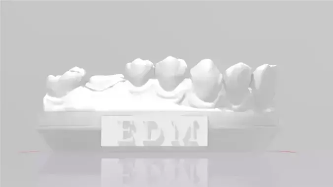 EDM Dental Practice Model Crown and Class 1 3D print model