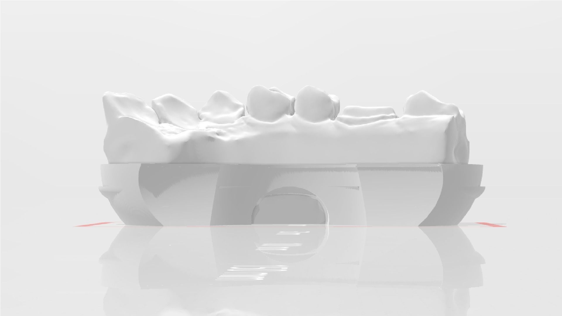EDM Dental Practice Model Crown and Class 1 3D print model_1