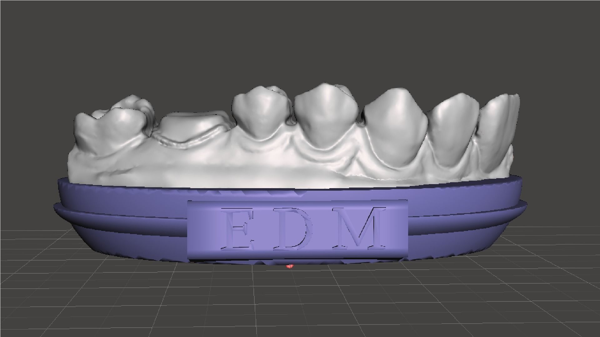 EDM Dental Practice Model Crown and Class 1 3D print model_4