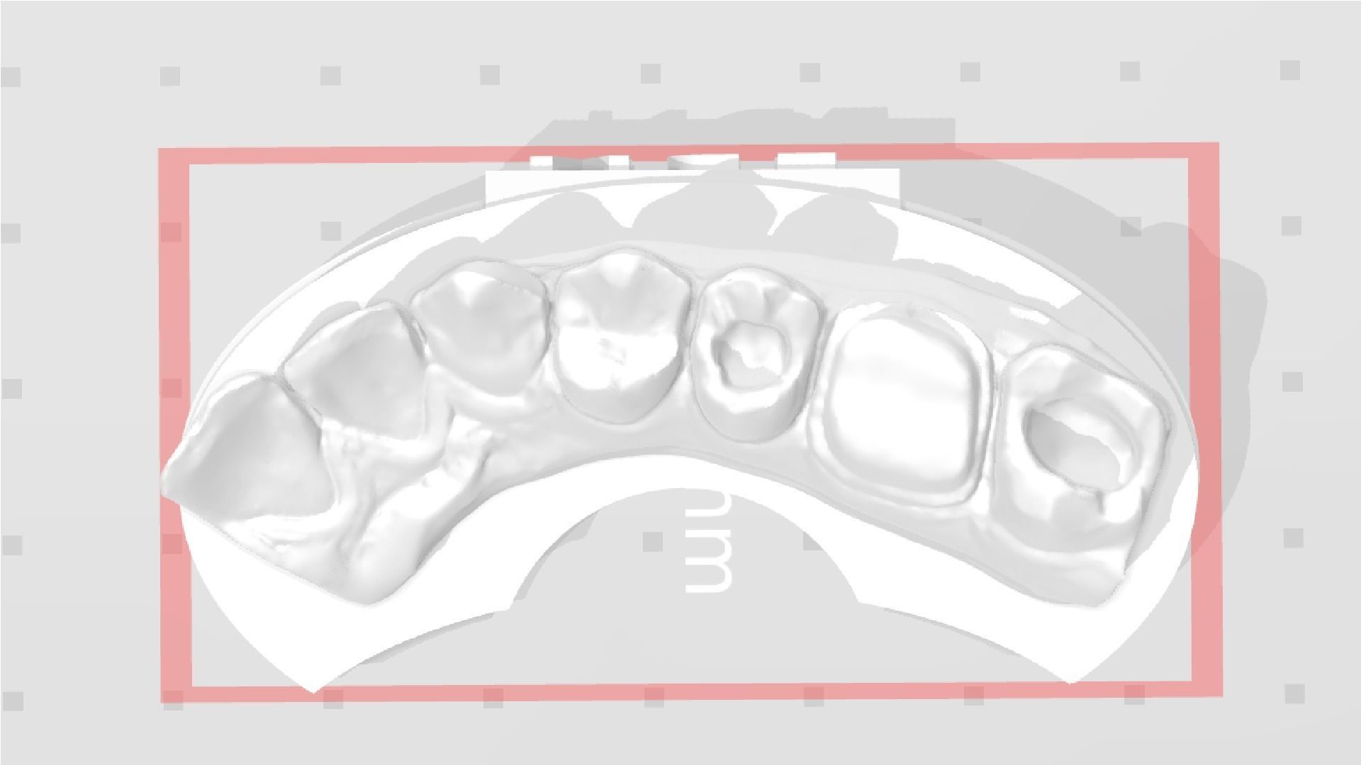 EDM Dental Practice Model Crown and Class 1 3D print model_2
