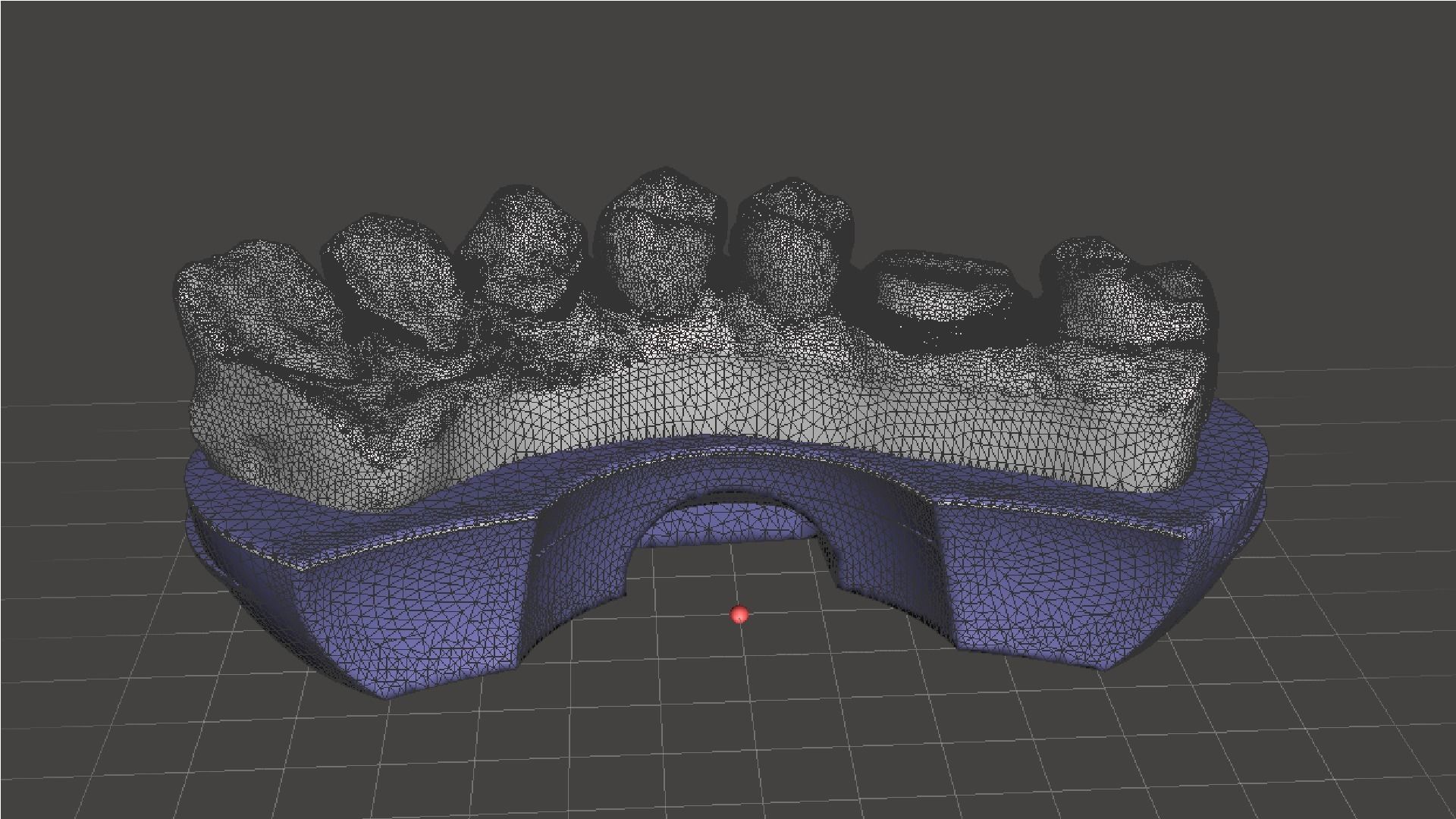 EDM Dental Practice Model Crown and Class 1 3D print model_7