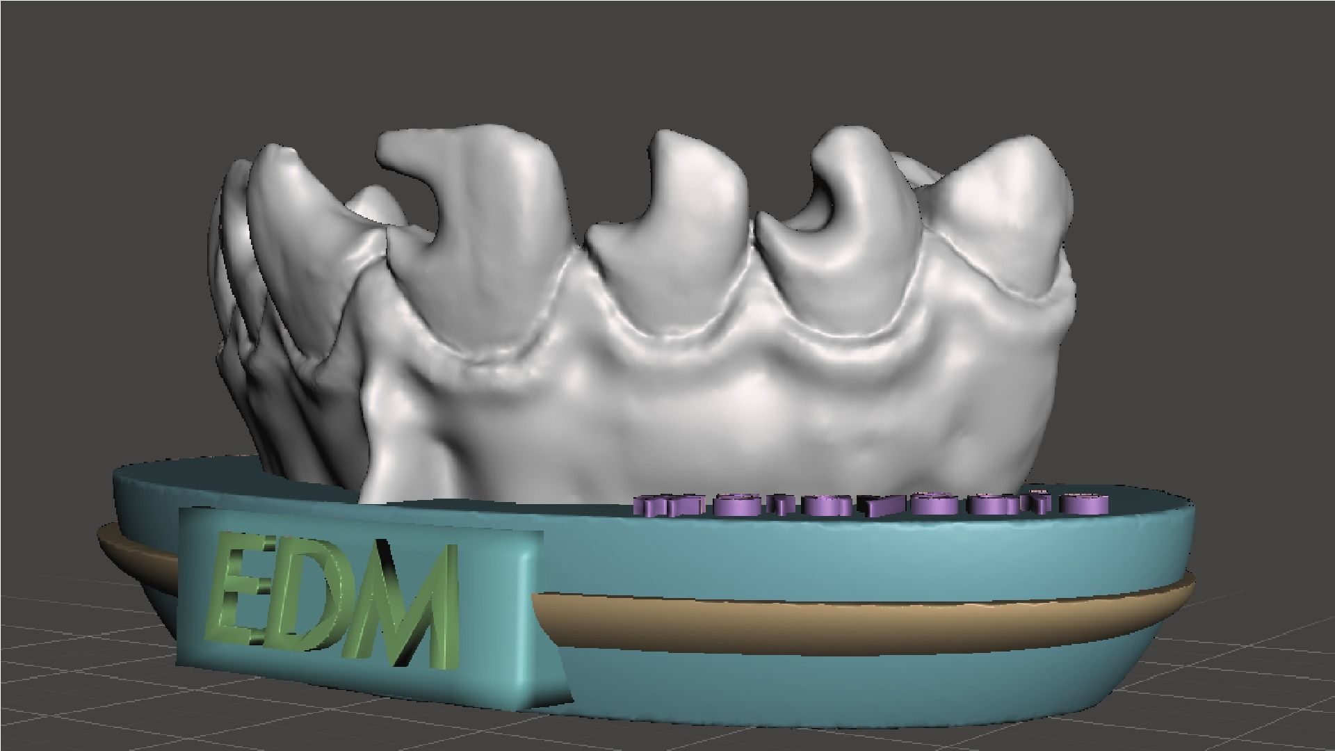 EDM Dental Practice Exclusive Model Class 3 and 4 3D print model_6