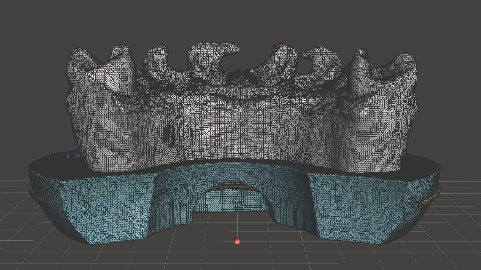 EDM Dental Practice Exclusive Model Class 3 and 4 3D print model_13