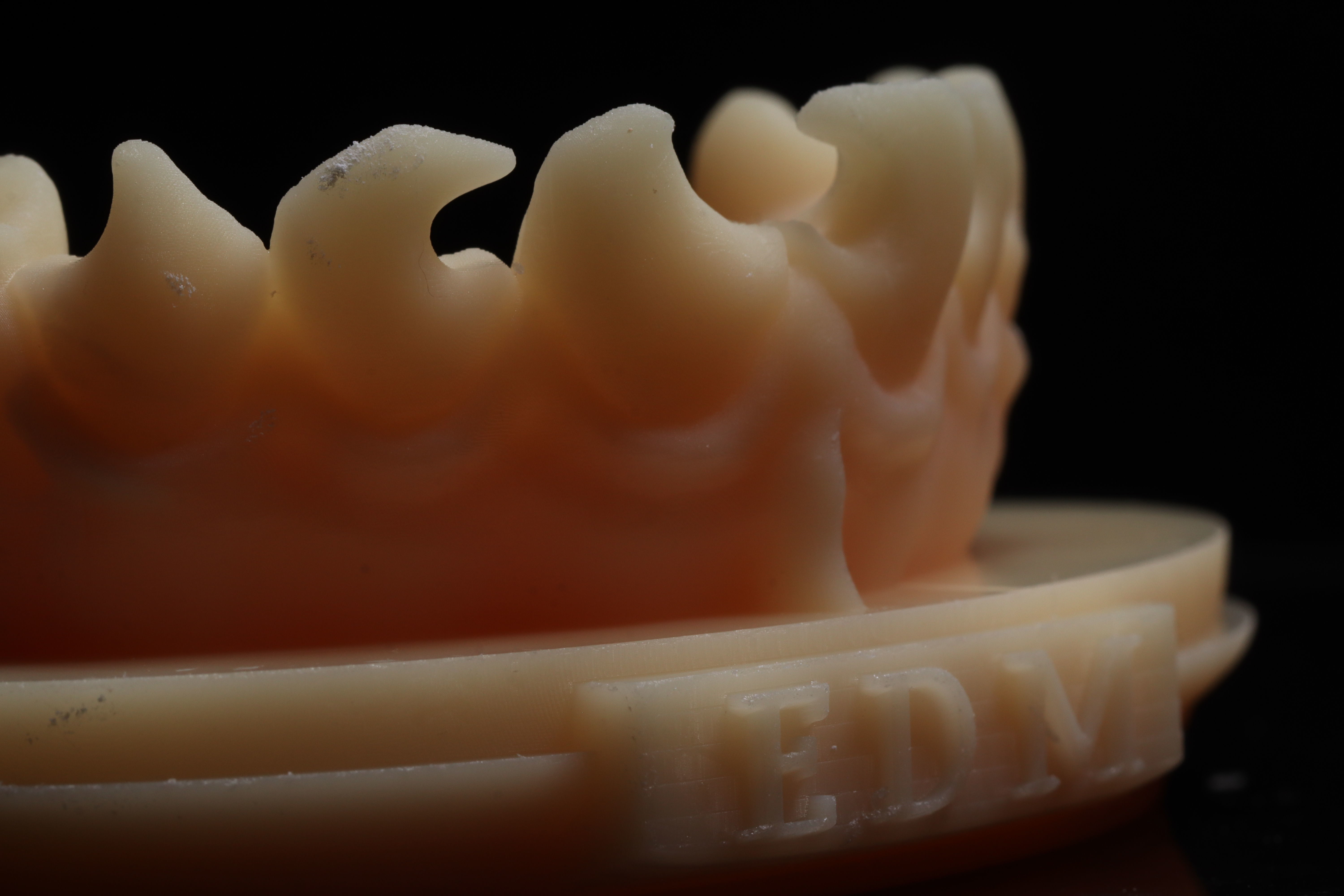 EDM Dental Practice Exclusive Model Class 3 and 4 3D print model_5