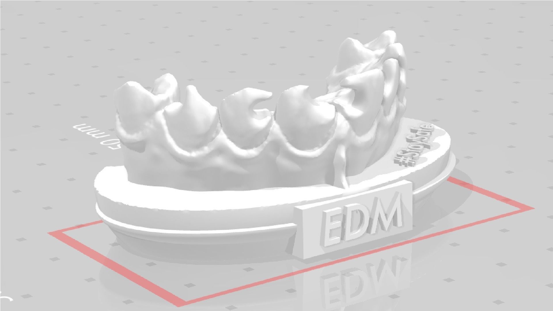EDM Dental Practice Exclusive Model Class 3 and 4 3D print model_9