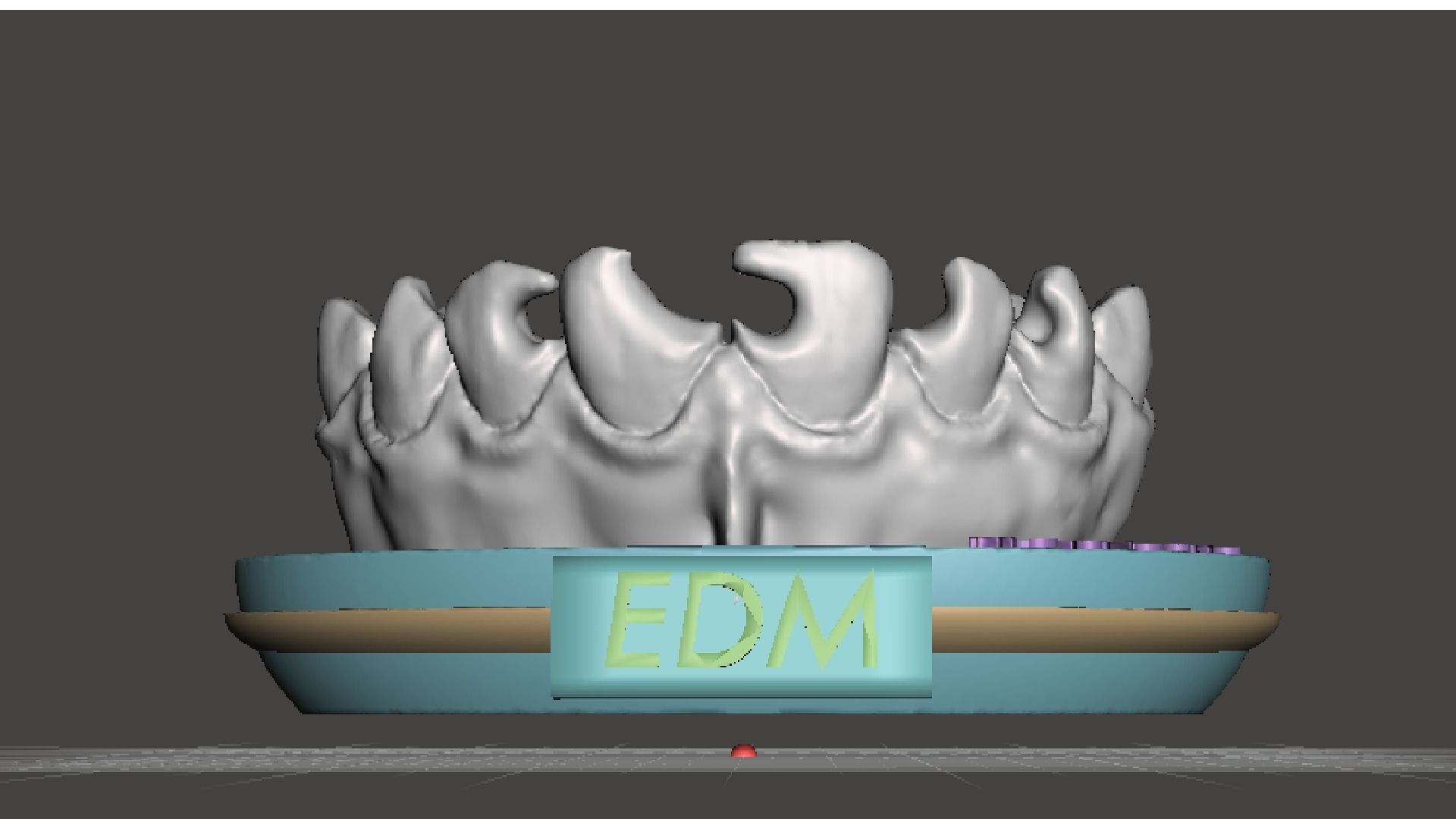 EDM Dental Practice Exclusive Model Class 3 and 4 3D print model_2