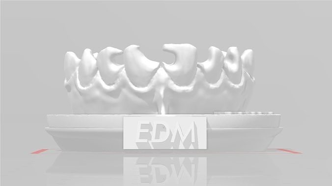EDM Dental Practice Exclusive Model Class 3 and 4 3D print model