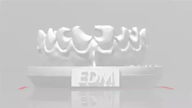 EDM Dental Practice Exclusive Model Class 3 and 4 3D print model