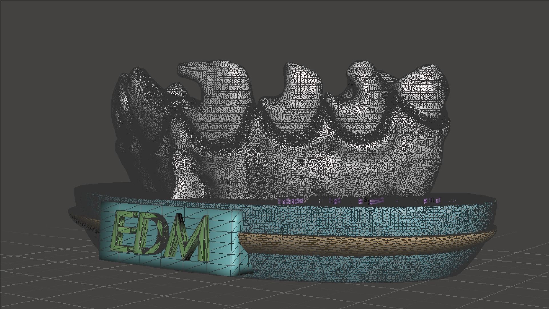 EDM Dental Practice Exclusive Model Class 3 and 4 3D print model_11