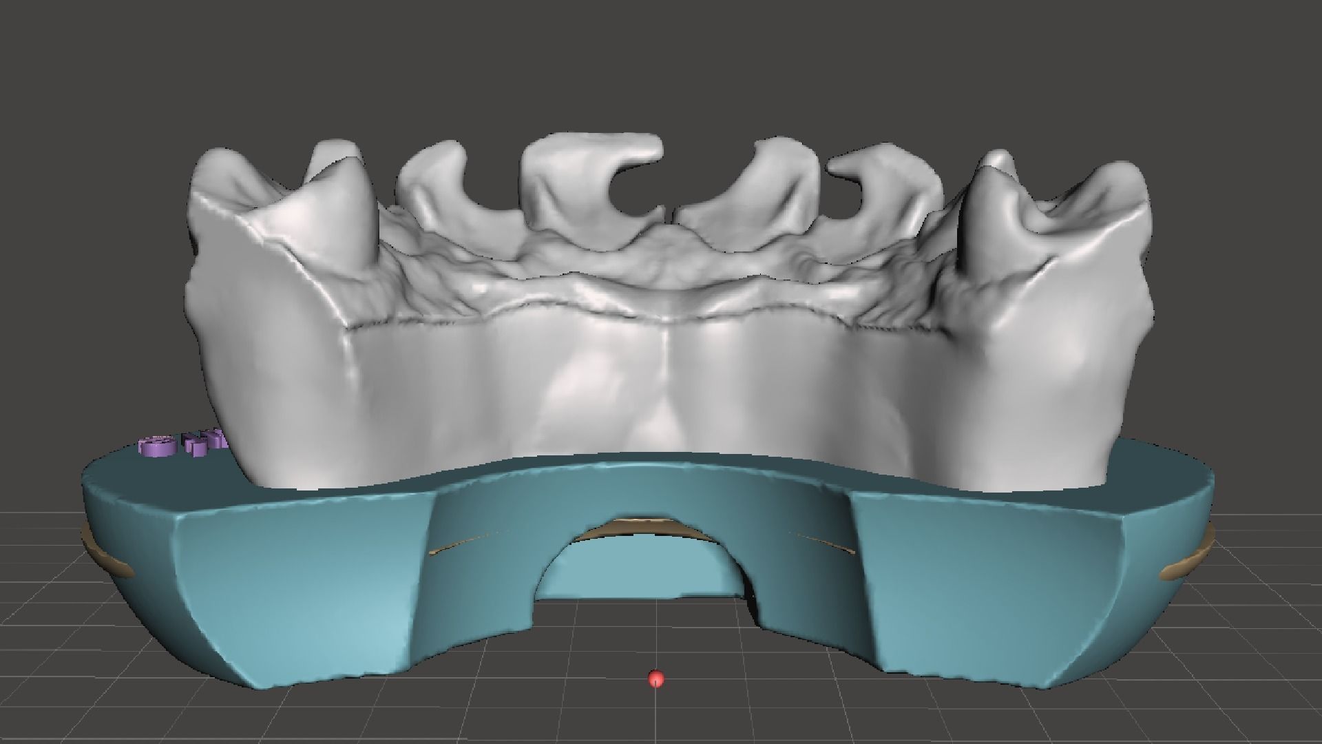 EDM Dental Practice Exclusive Model Class 3 and 4 3D print model_1