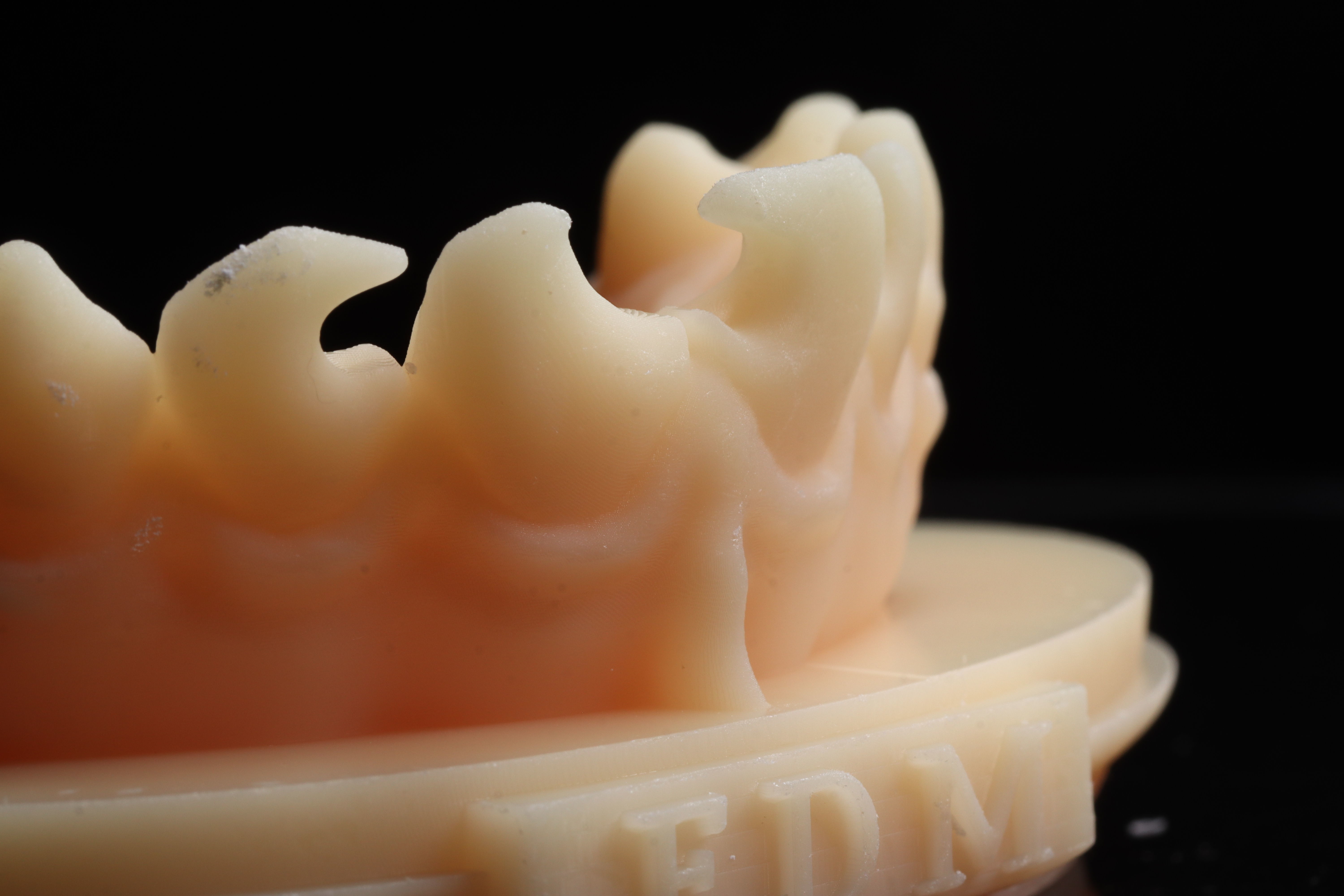 EDM Dental Practice Exclusive Model Class 3 and 4 3D print model_4