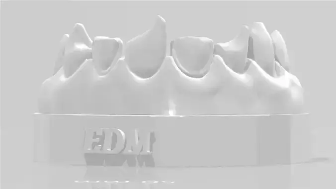 EDM Dental Practice Exclusive Model Class 4 and Direct Veneer 3D print model