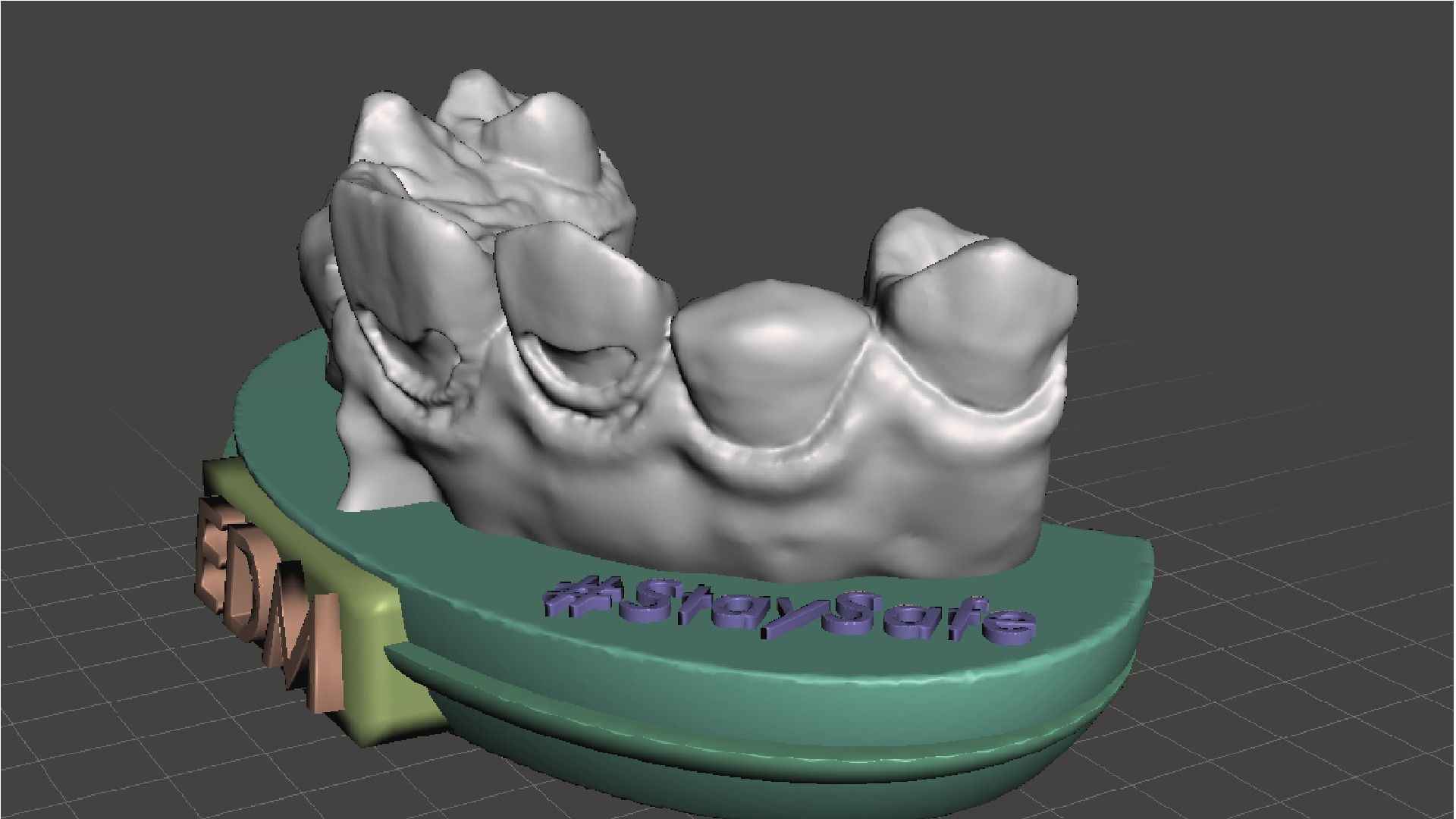 EDM Dental Practice Exclusive Model Class 5 and 6 3D print model_3