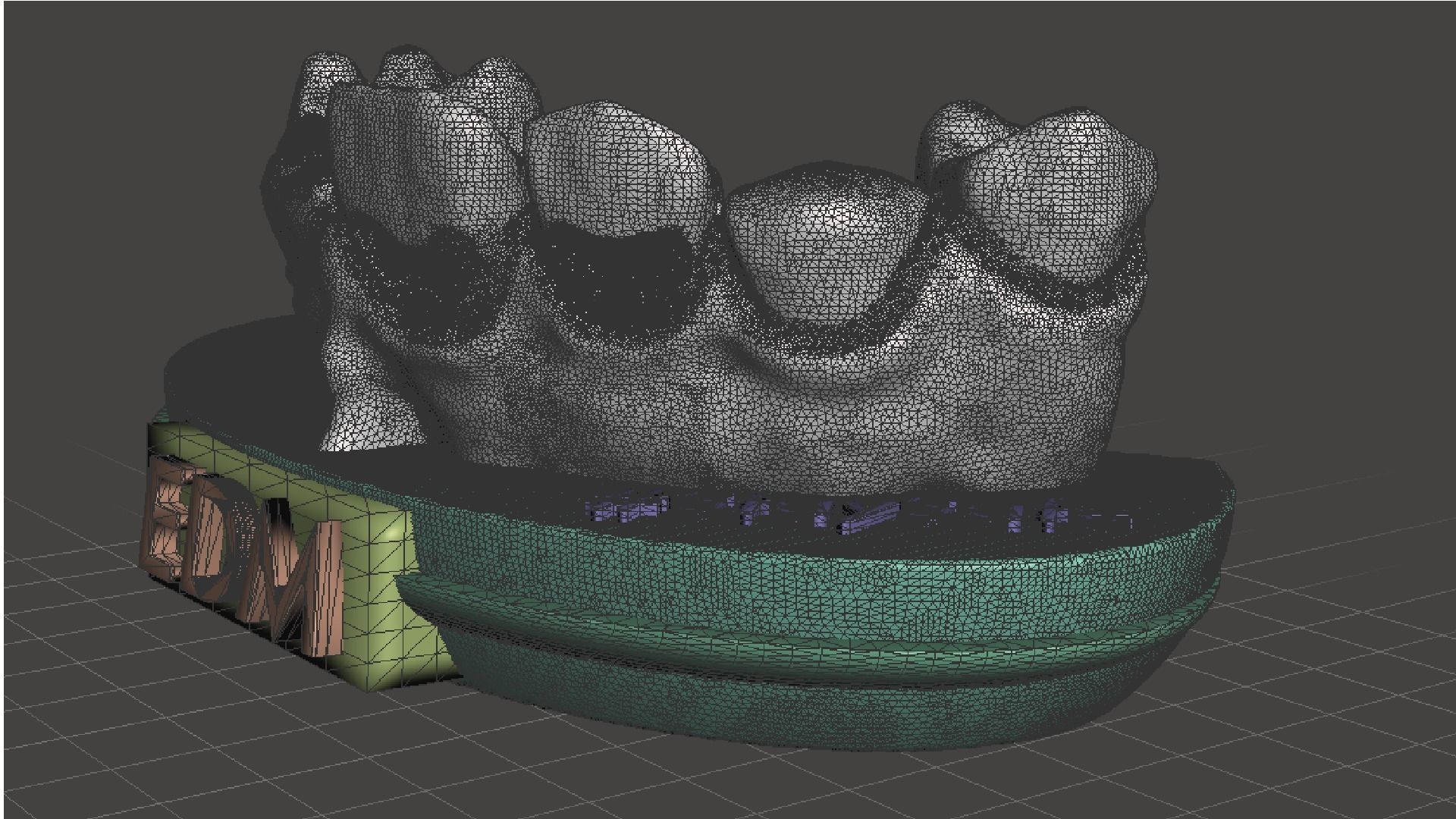 EDM Dental Practice Exclusive Model Class 5 and 6 3D print model_7