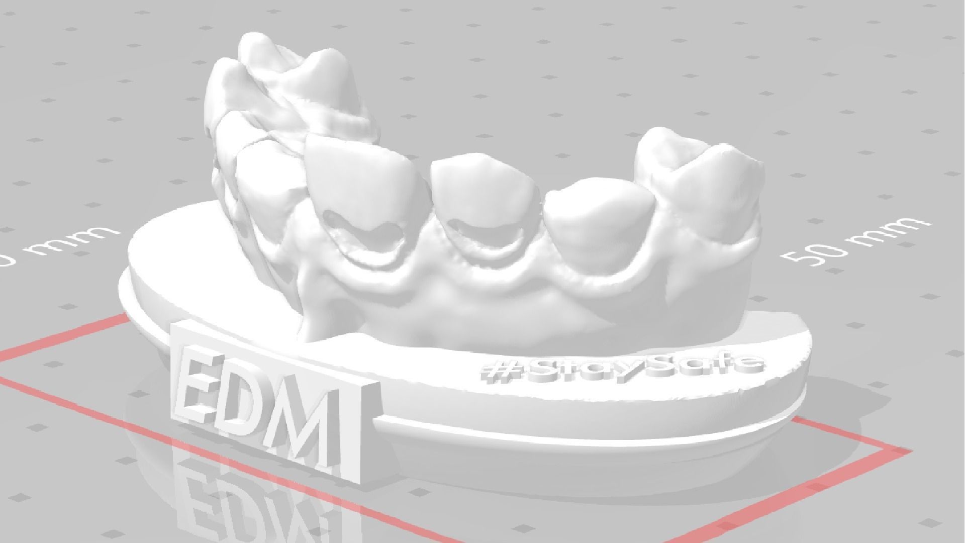 EDM Dental Practice Exclusive Model Class 5 and 6 3D print model_2