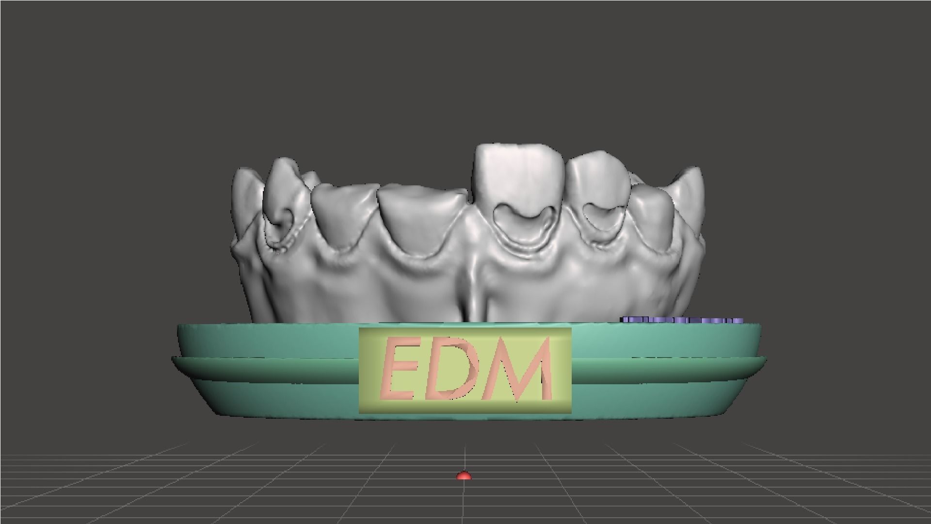 EDM Dental Practice Exclusive Model Class 5 and 6 3D print model_1