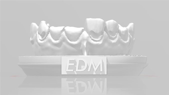 EDM Dental Practice Exclusive Model Class 5 and 6 3D print model