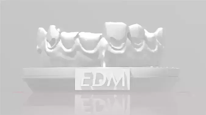 EDM Dental Practice Exclusive Model Class 5 and 6 3D print model