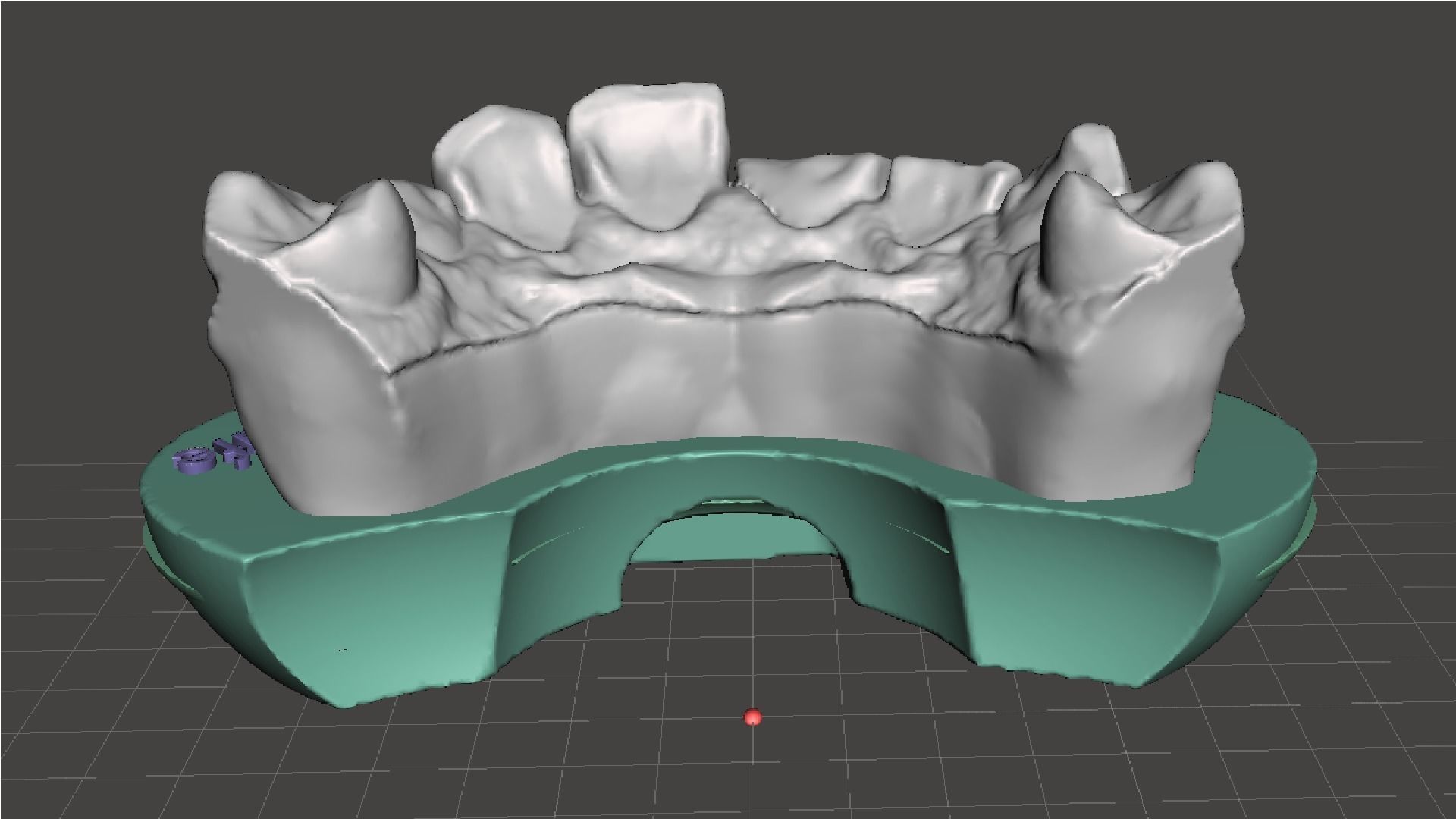 EDM Dental Practice Exclusive Model Class 5 and 6 3D print model_4