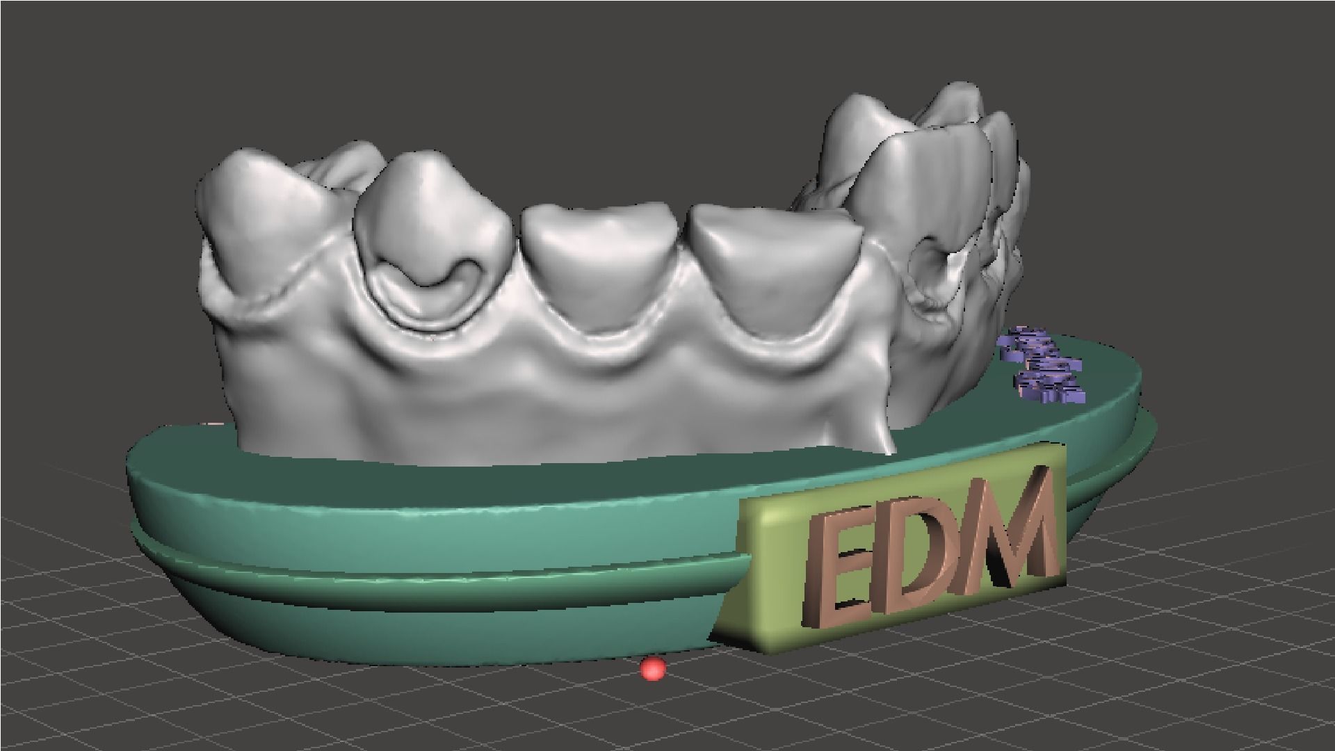 EDM Dental Practice Exclusive Model Class 5 and 6 3D print model_5