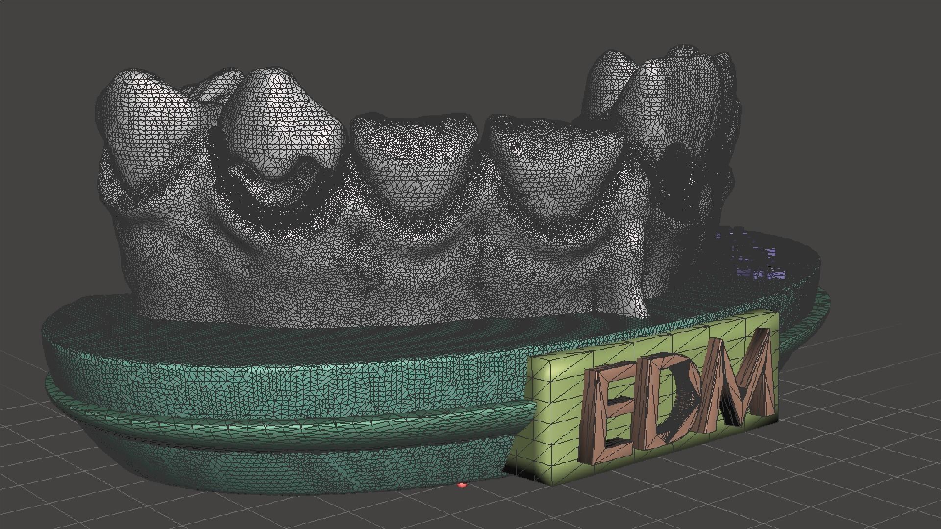 EDM Dental Practice Exclusive Model Class 5 and 6 3D print model_6